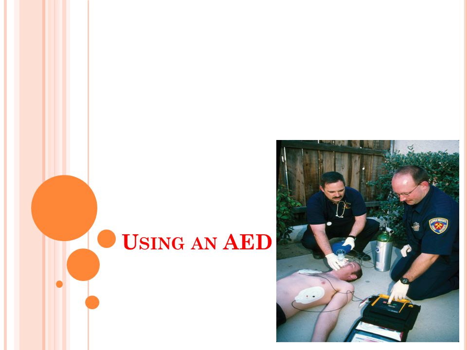 Using an AED