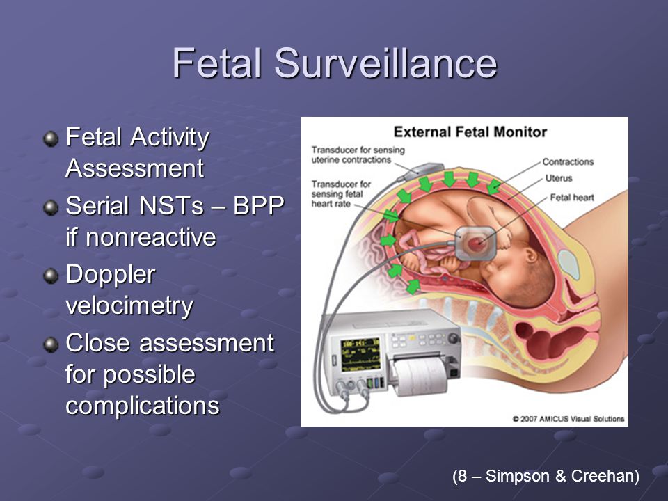 Fetal Surveillance Fetal Activity Assessment