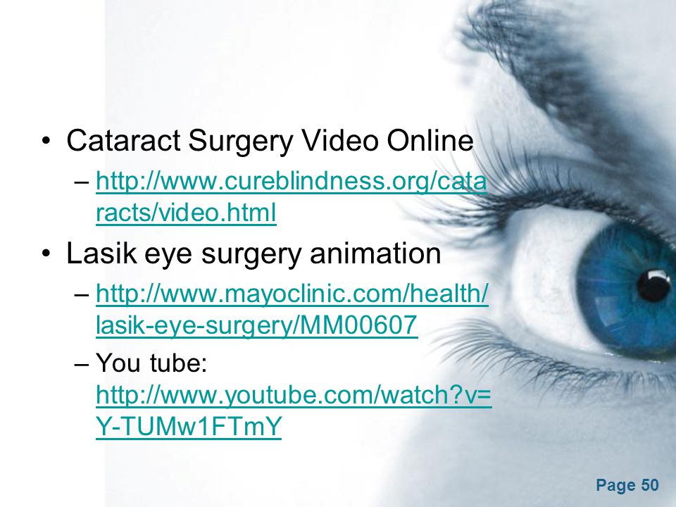 Sensory Organs The Eye Free Powerpoint Templates. - ppt video online  download