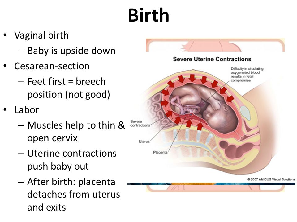 Know the differences between vaginal birth or c section which is better