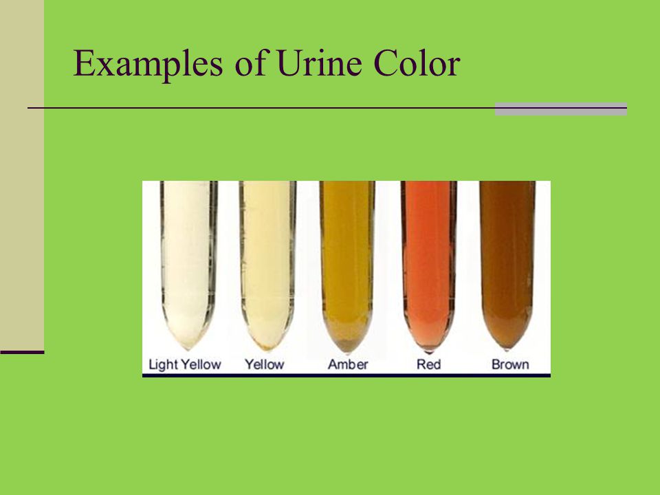 Urine Color And Clarity Chart