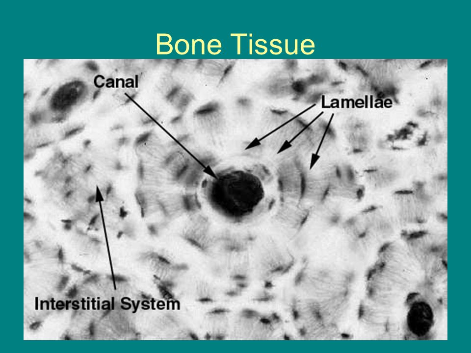 Bone Tissue.