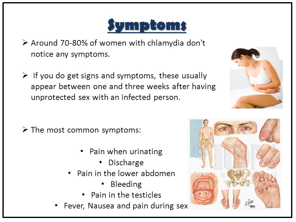 Chlamydia Symptoms Treatment