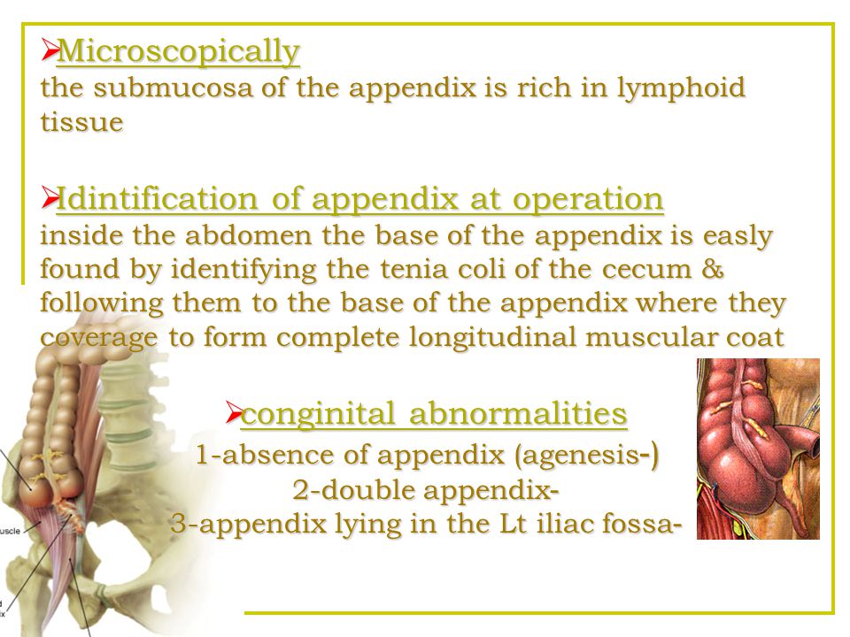 Idintification of appendix at operation