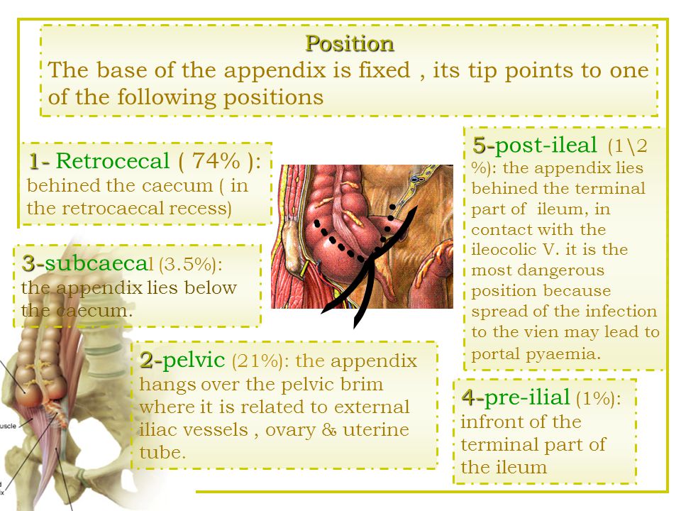 Position The base of the appendix is fixed , its tip points to one of the following positions.
