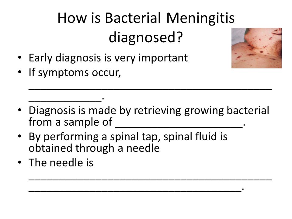 symptoms-of-bacterial-meningitis-in-adults-amatuer-porn-movie-database