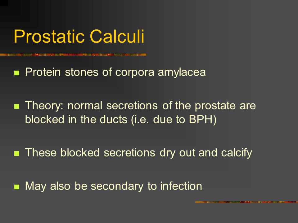 prostate calcification treatment