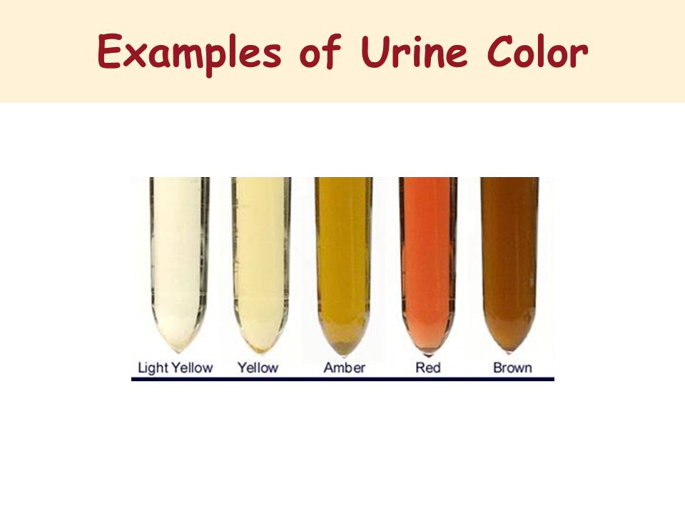 Urine Sample Colour Chart