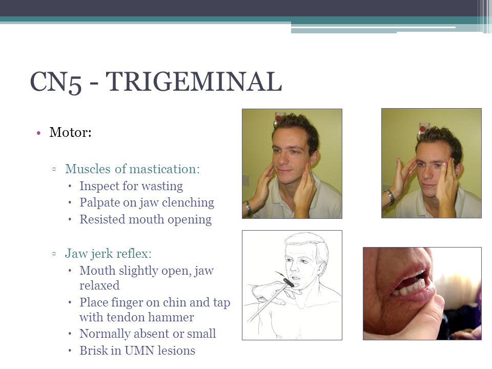 Cranial Nerve Examination ppt video online download Cranial Nerve Examination ppt video online download