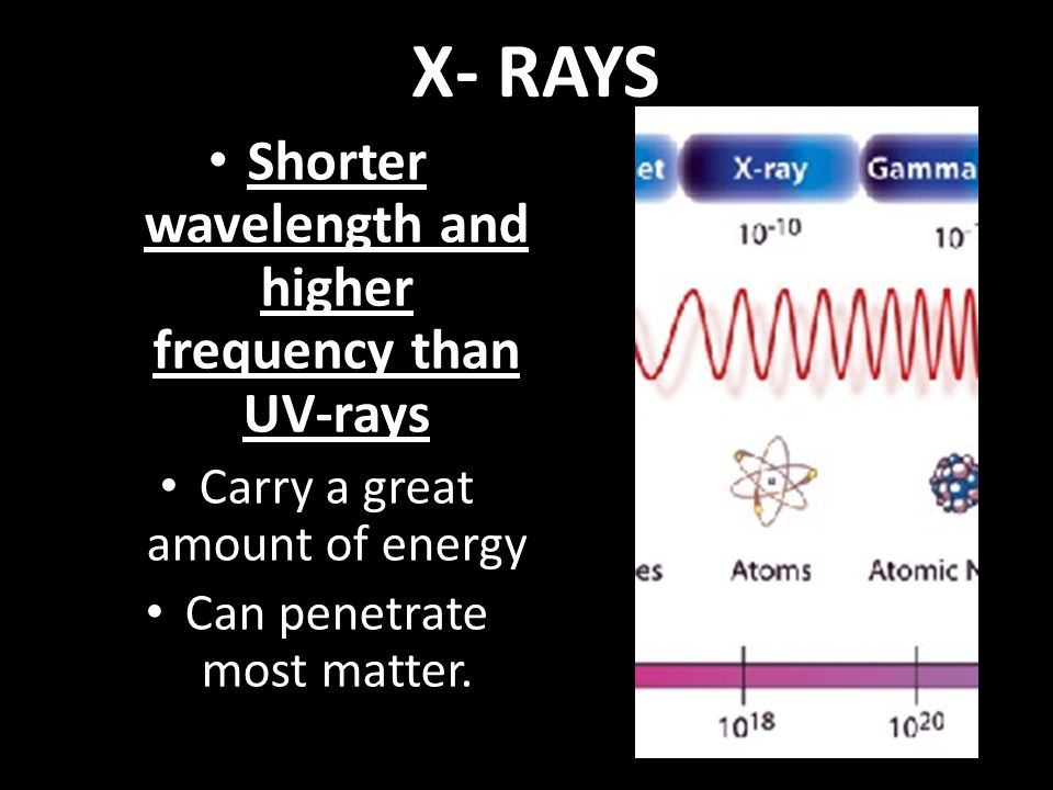 Shorter wavelength and higher frequency than UV-rays