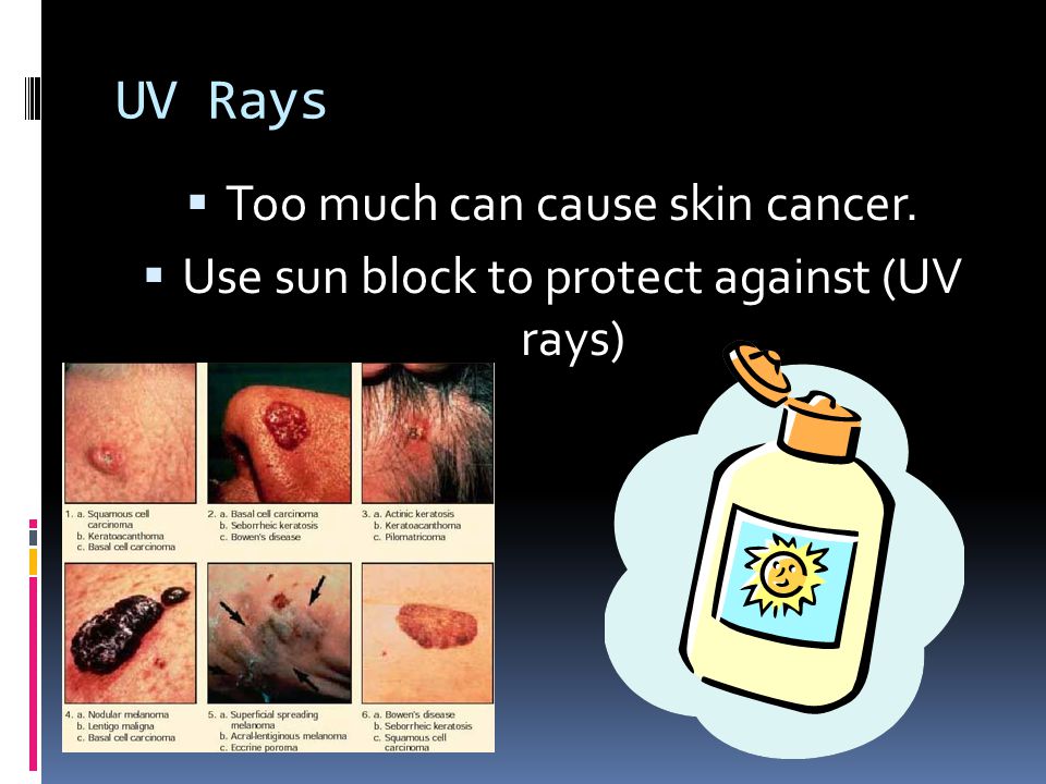 UV Rays Too much can cause skin cancer.