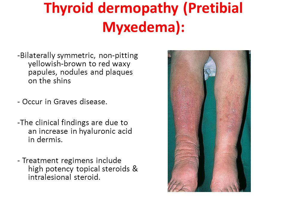 Cutaneous Manifestation Of Systemic Disease Ppt Video Online Download