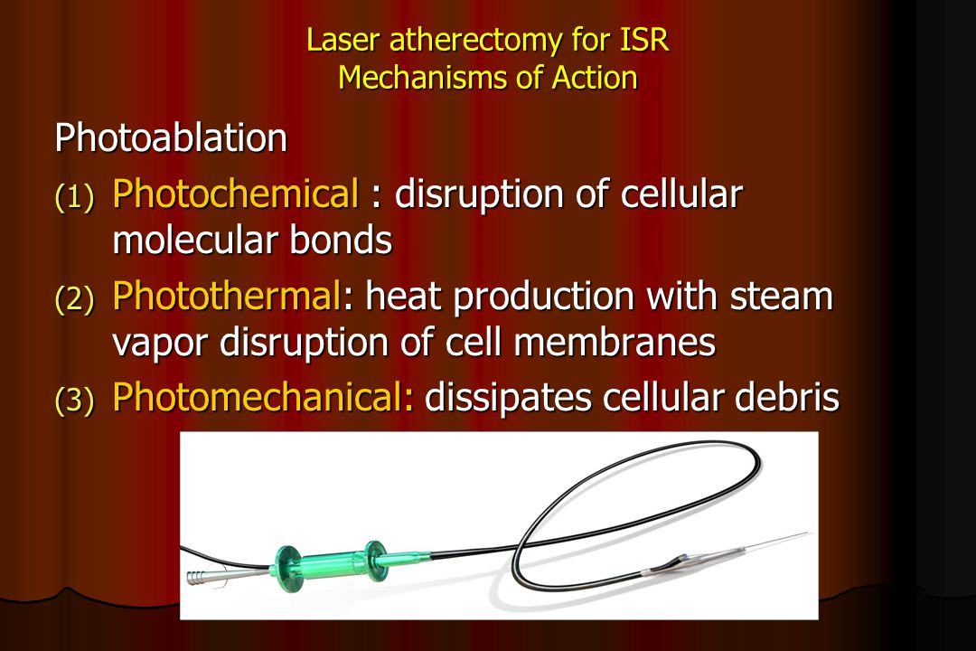 Laser atherectomy for ISR Mechanisms of Action