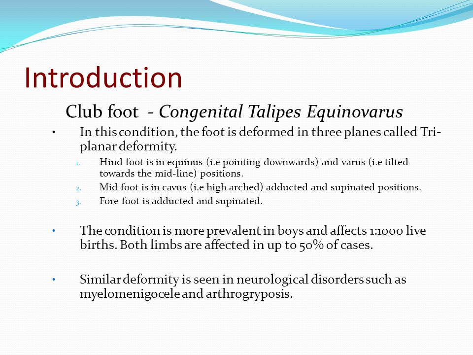 1 Case A New Born Child Is Presented With B L Clubfeet Ppt Video Online Download 1 Case A New Born Child Is Presented With B L Clubfeet Ppt Video Online Download