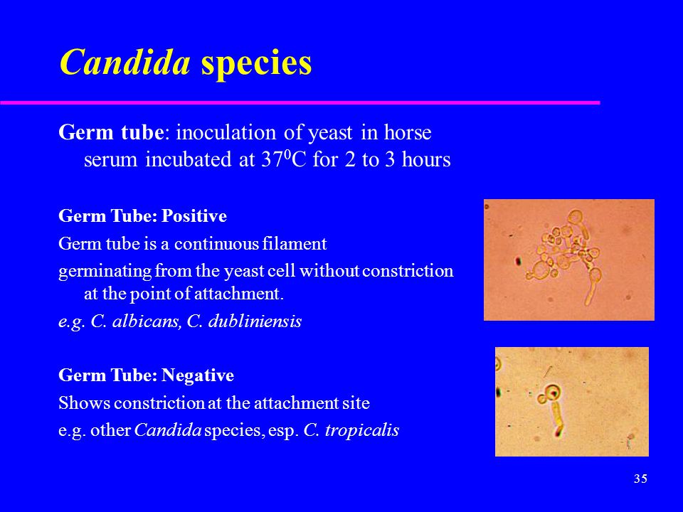 Candida+species+Germ+tube%3A+inoculation+of+yeast+in+horse+serum+incubated+at+370C+for+2+to+3+hours.+Germ+Tube%3A+Positive..jpg