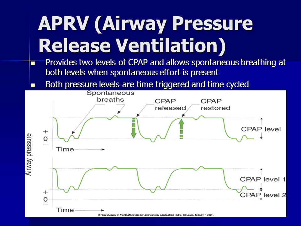 Airway Pressure Release Ventilation (APRV) - ppt download