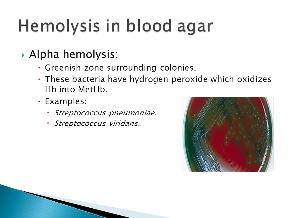 4 blood agar and hemolysis and mac-conkey.ppt