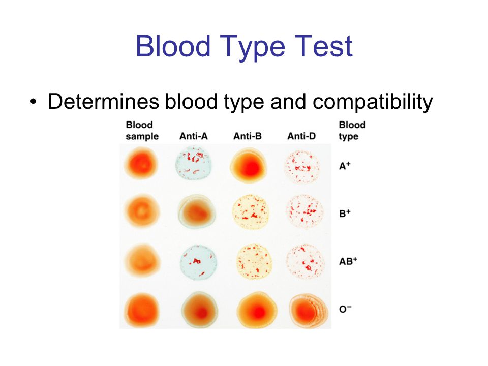 Blood Typing Lab Whodunit?. - ppt video online download