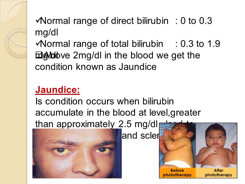 Estimation of serum bilirubin (total and direct) - ppt video online download