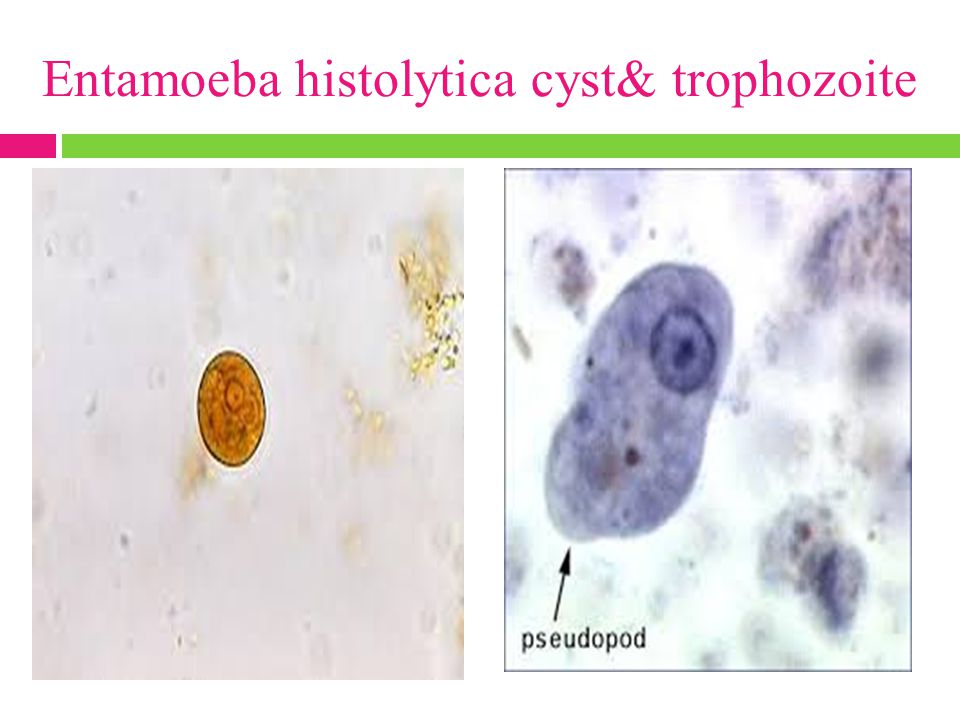 Entamoeba histolytica cyst& trophozoite