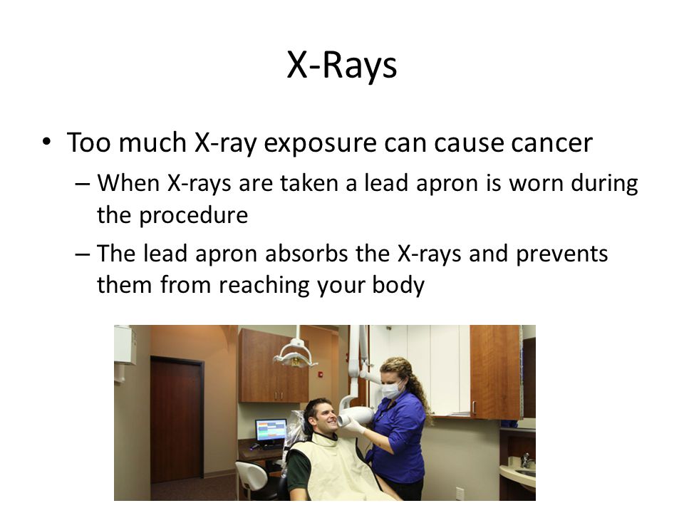 X-Rays Too much X-ray exposure can cause cancer