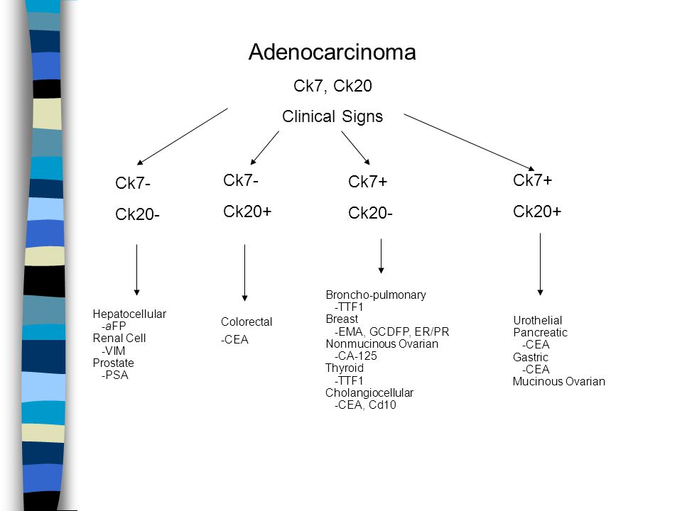 Ck7+ ck20+ tumors