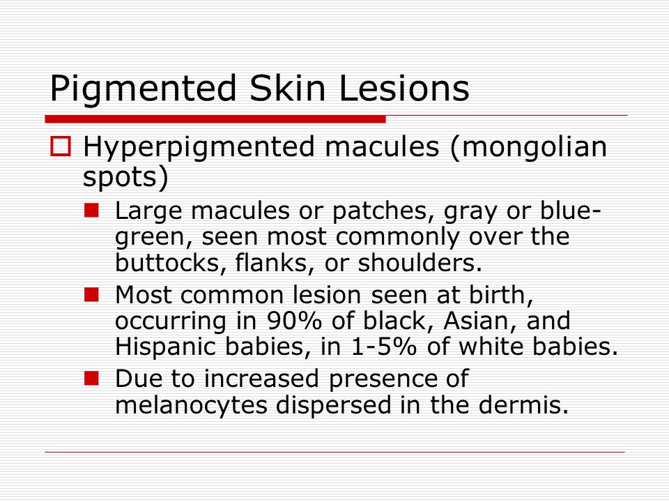 Pigmented Skin Lesions