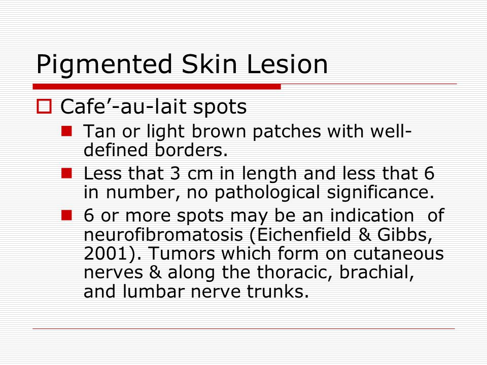 Pigmented Skin Lesion Cafe’-au-lait spots