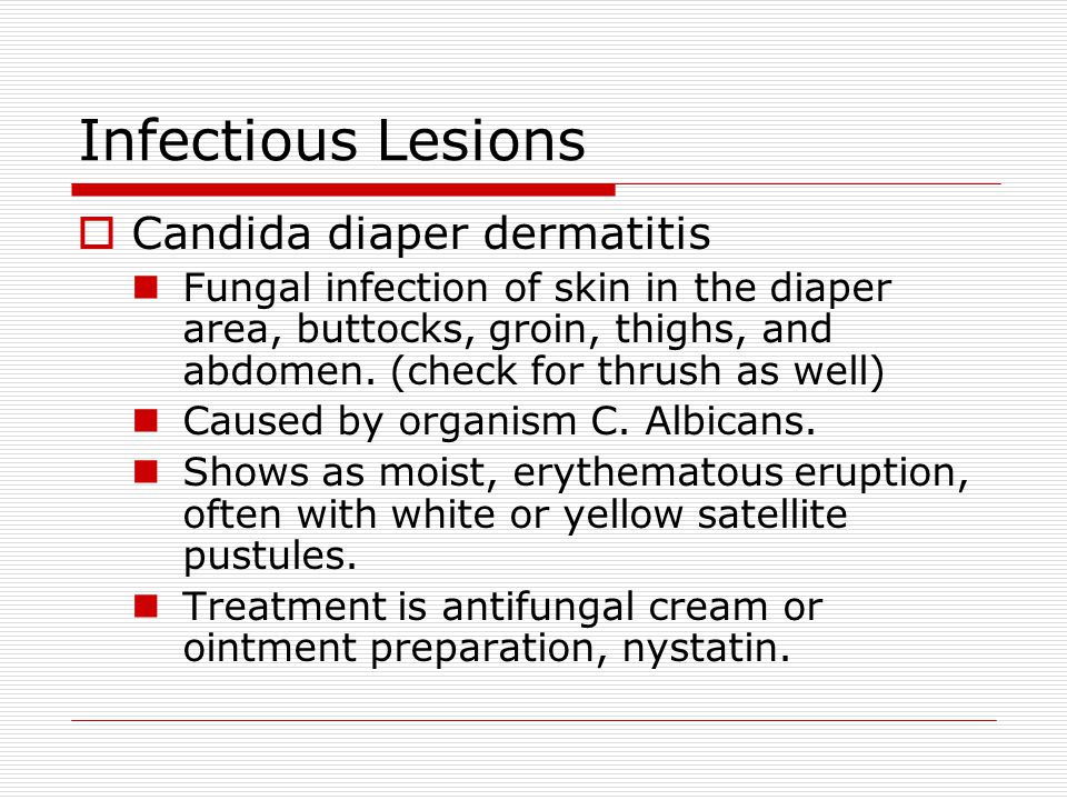 Infectious Lesions Candida diaper dermatitis