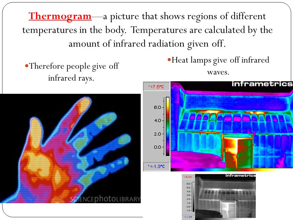 Thermogram—a picture that shows regions of different temperatures in the body. Temperatures are calculated by the amount of infrared radiation given off.