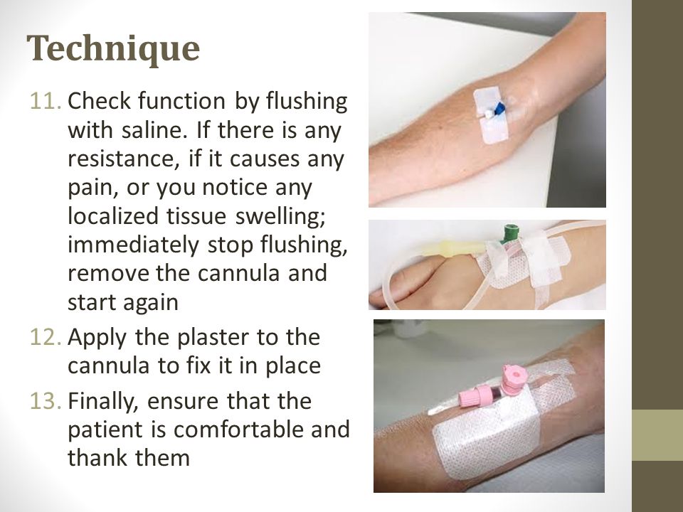 Intravenous cannulation - ppt video online download