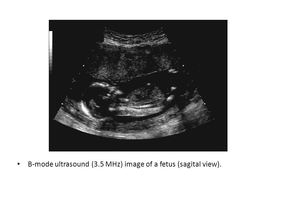 Ultrasonography. - ppt download