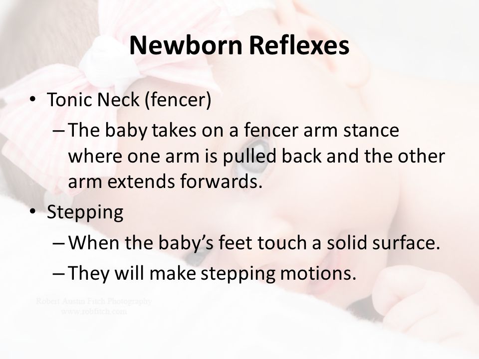 Newborn Reflexes Tonic Neck (fencer)