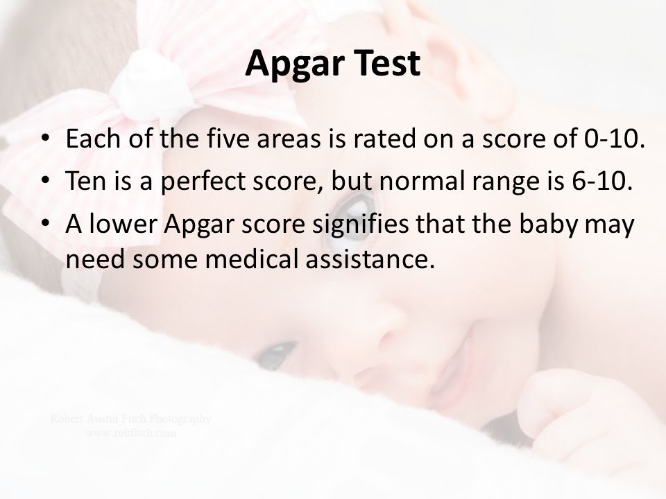 Apgar Test Each of the five areas is rated on a score of 0-10.