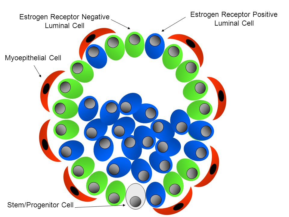 Estrogen Receptor Positive Luminal Cell Estrogen Receptor Negative