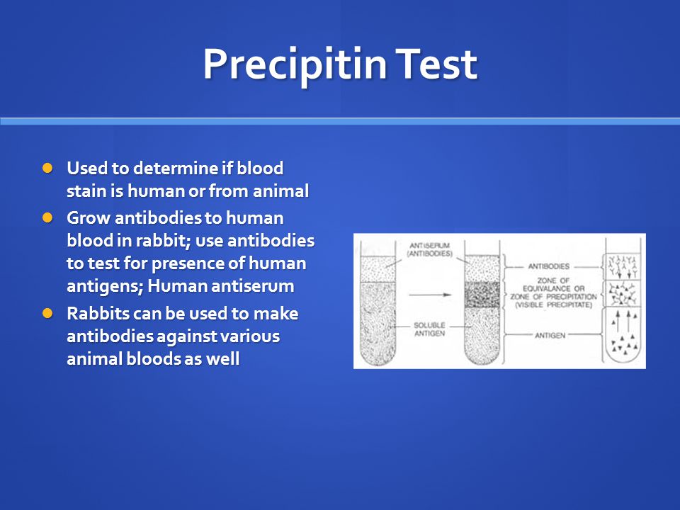 Forensic Serology Chapter ppt video online download Forensic Serology Chapter ppt video online download