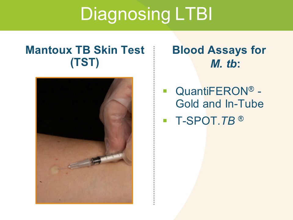 Mantoux TB Skin Test (TST)