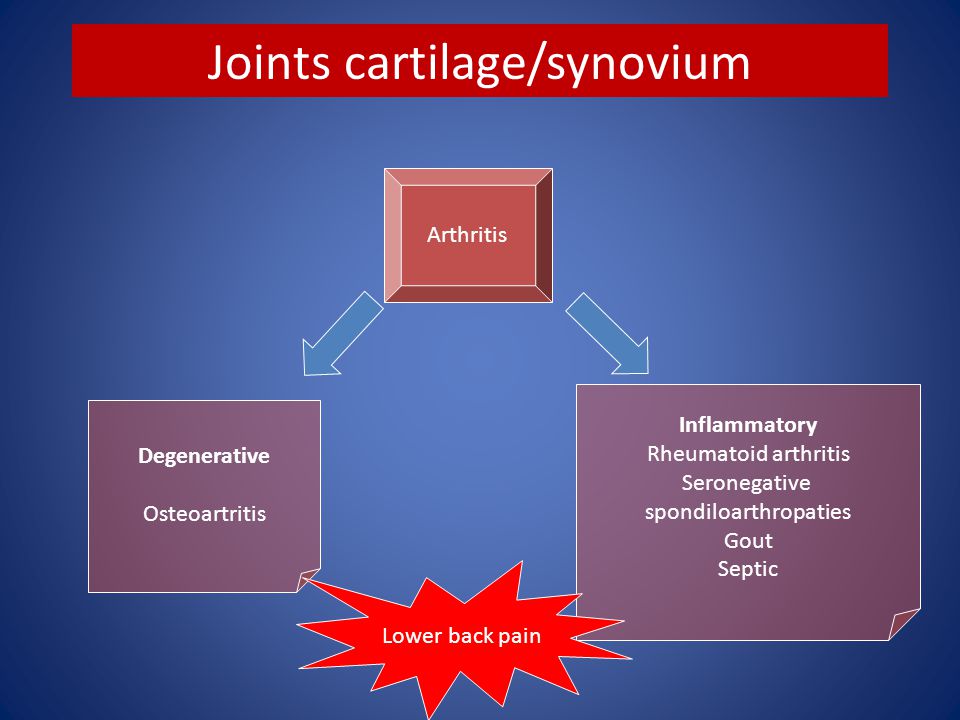 arthritis polyarthritis hogyan kezelhető