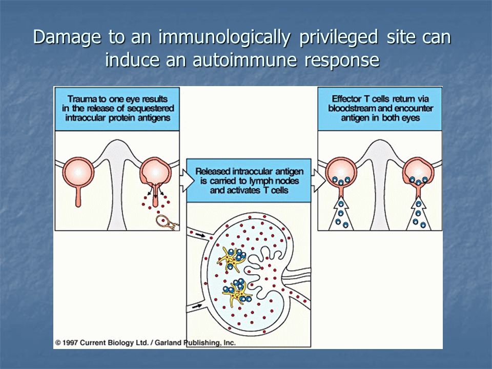 Антигены вызывают. Способность антигена вызывать иммунный ответ. Иммунологически привилегированные зоны. Аутоиммунный симпатический офтальмит.