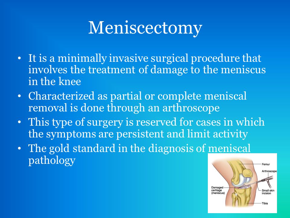 Meniscectomy It is a minimally invasive surgical procedure that involves the treatment of damage to the meniscus in the knee.