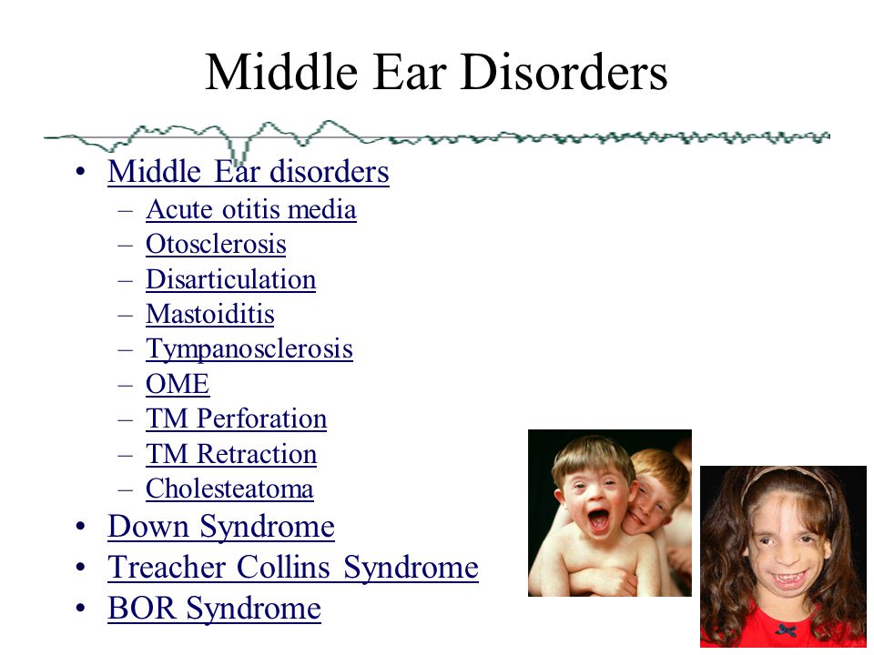 Middle Ear Disorders Middle Ear disorders Down Syndrome
