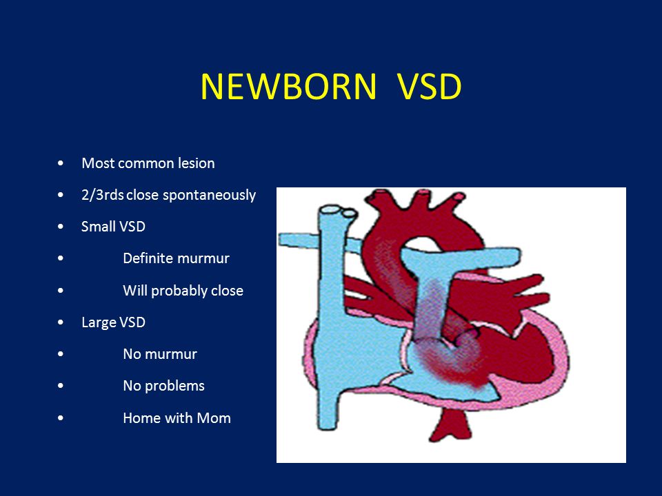 Pediatric Congenital Heart Disease - ppt video online download