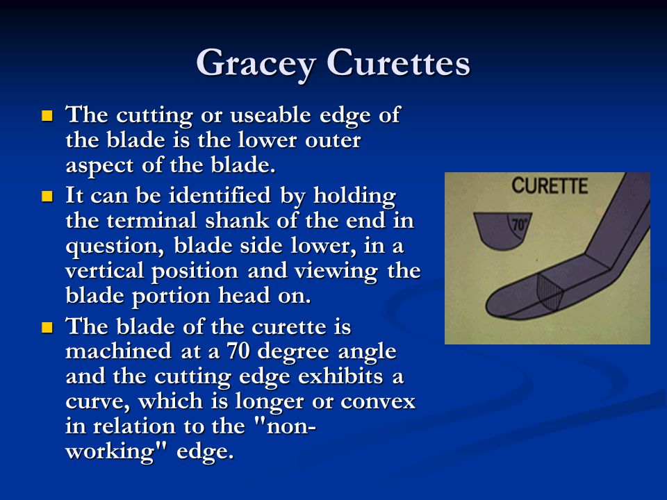 Gracey Curettes The cutting or useable edge of the blade is the lower outer aspect of the blade.