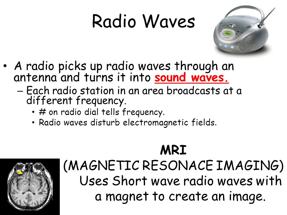 Radio Waves MRI (MAGNETIC RESONACE IMAGING)