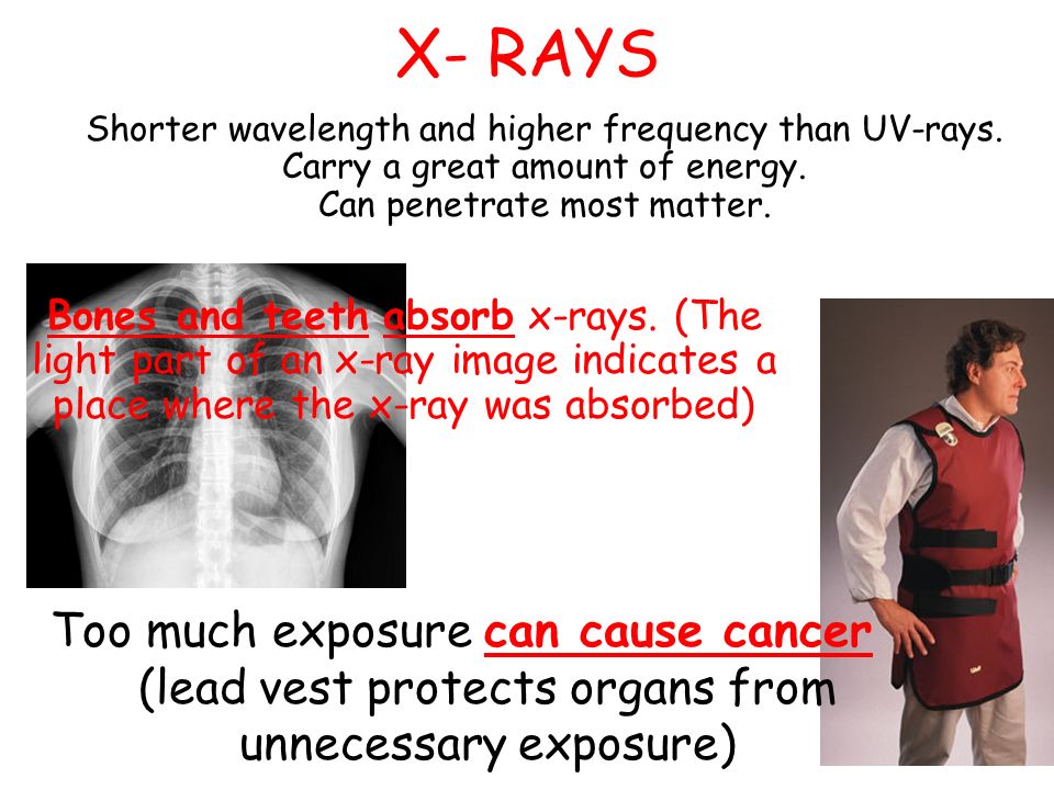 X- RAYS Too much exposure can cause cancer