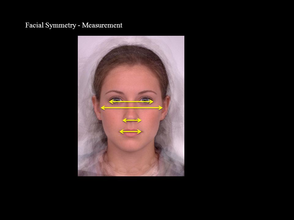 Facial Symmetry - Measurement