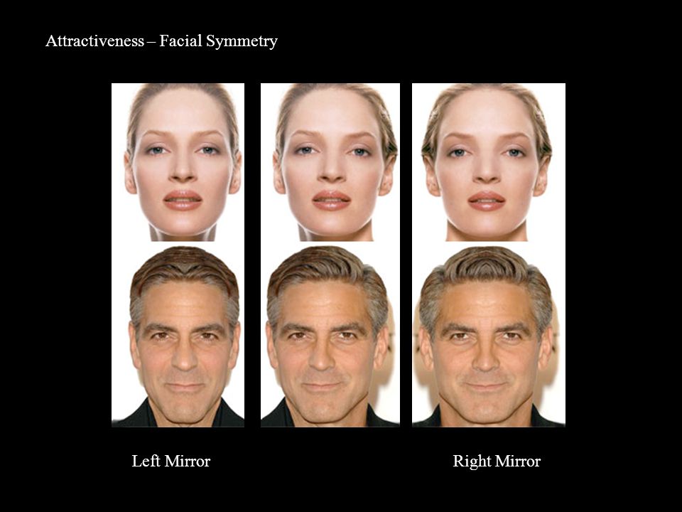 Attractiveness – Facial Symmetry