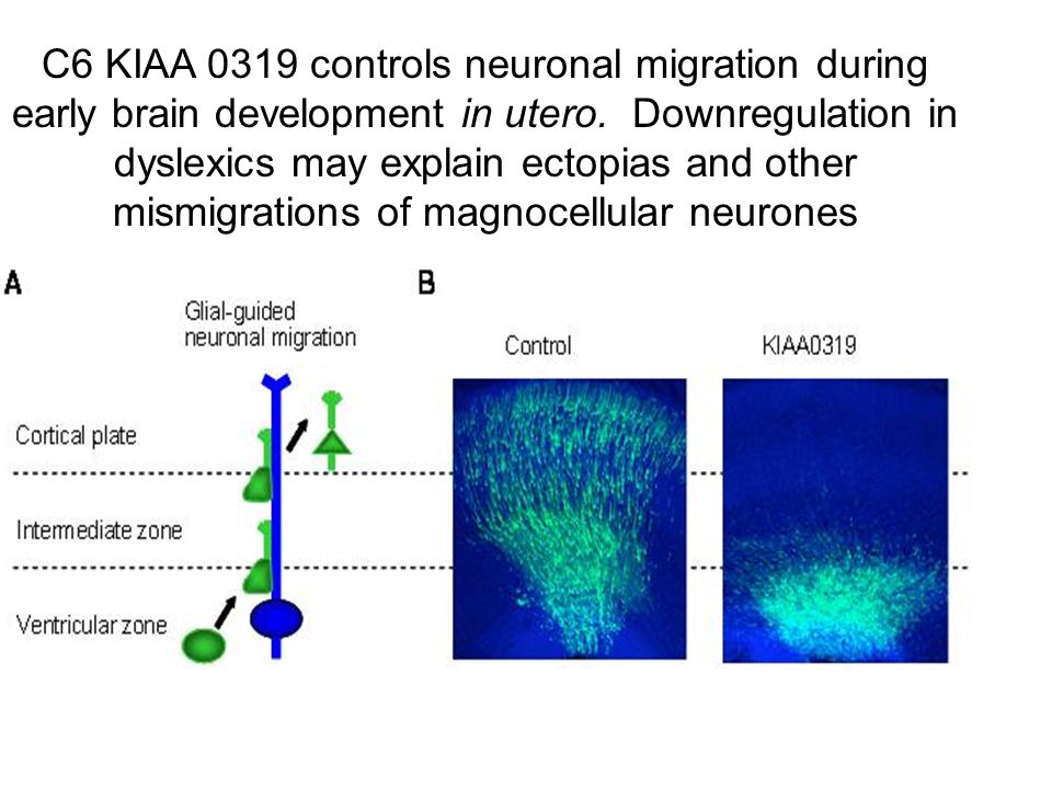 C6 KIAA 0319 controls neuronal migration during early brain development in utero.