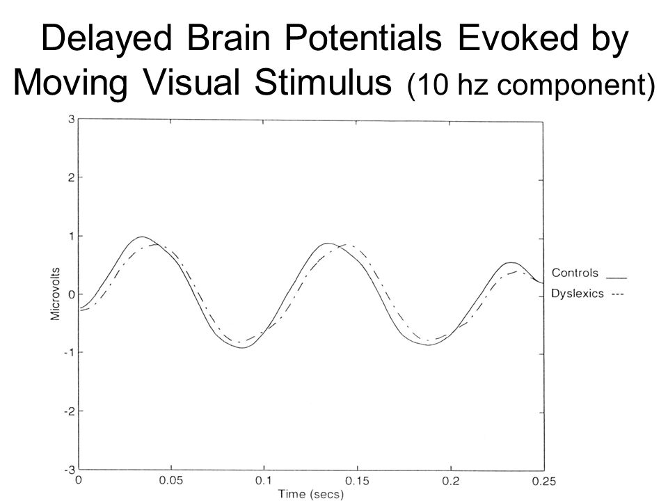 Delayed Brain Potentials Evoked by Moving Visual Stimulus (10 hz component)