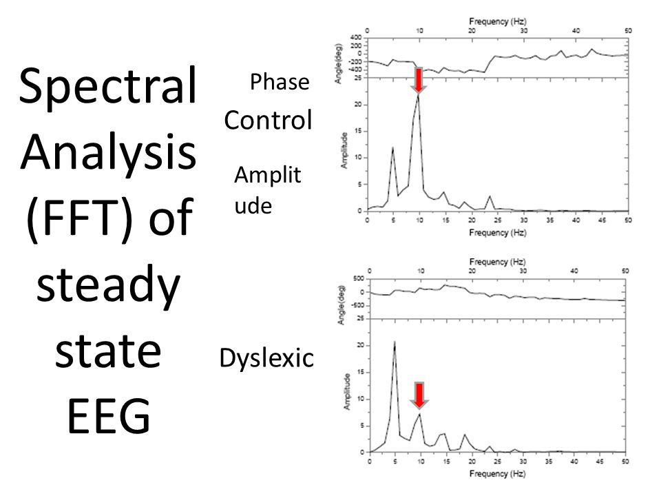 (FFT) of steady state EEG
